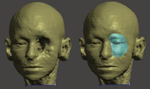 Inovação na Reabilitação Facial: A Revolução das Próteses de Silicone com Modelagem 3D e Manufatura Aditiva